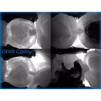 dexis-carivu2