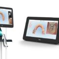 iTero Element 5D Plus Intraoral Scanner_1