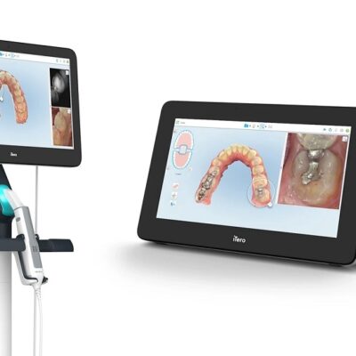 iTero Element 5D Plus Intraoral Scanner_1