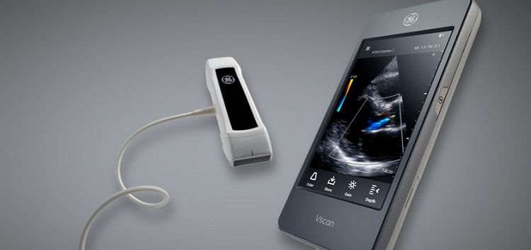 Vscan Extend Handheld Ultrasound_1