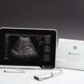 Terason uSmart 3200t Ultrasound