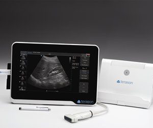 Terason uSmart 3200t Ultrasound